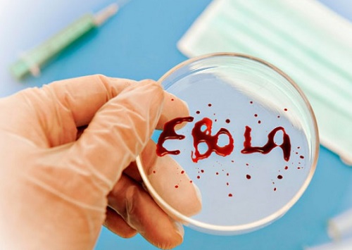 Россия испытает вакцину против Эболы в гвинейском госпитале РУСАЛа