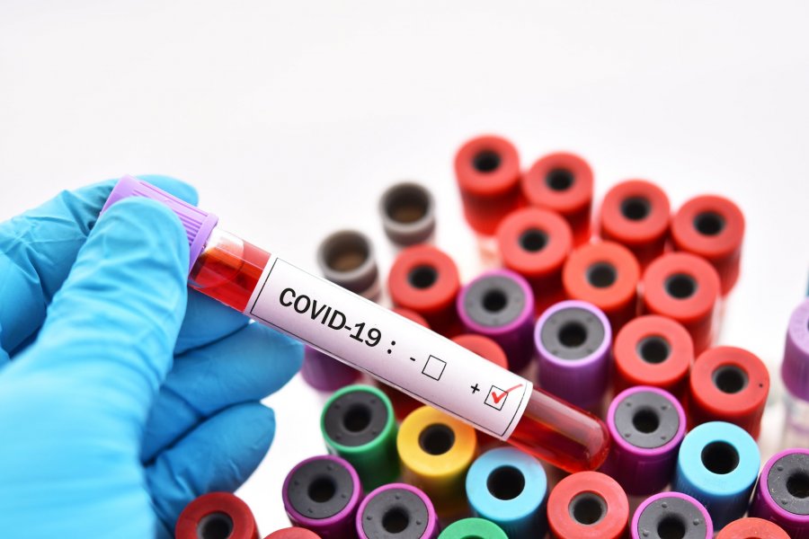 В Хакасии 95,7% заразившихся COVID-19 выздоровели