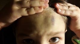 В Саяногорске ребенок упал с крыльца и ударился головой
