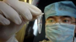 В Хакасии наблюдается снижение уровня заболеваемости гепатитом 