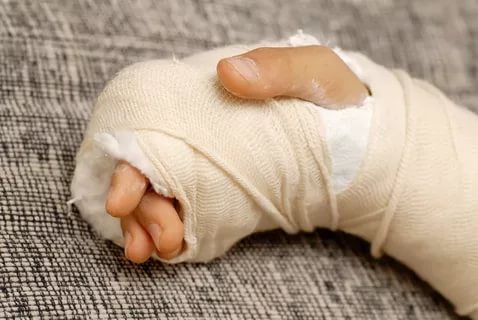 В Хакасии на уроке физкультуры школьник сломал руку