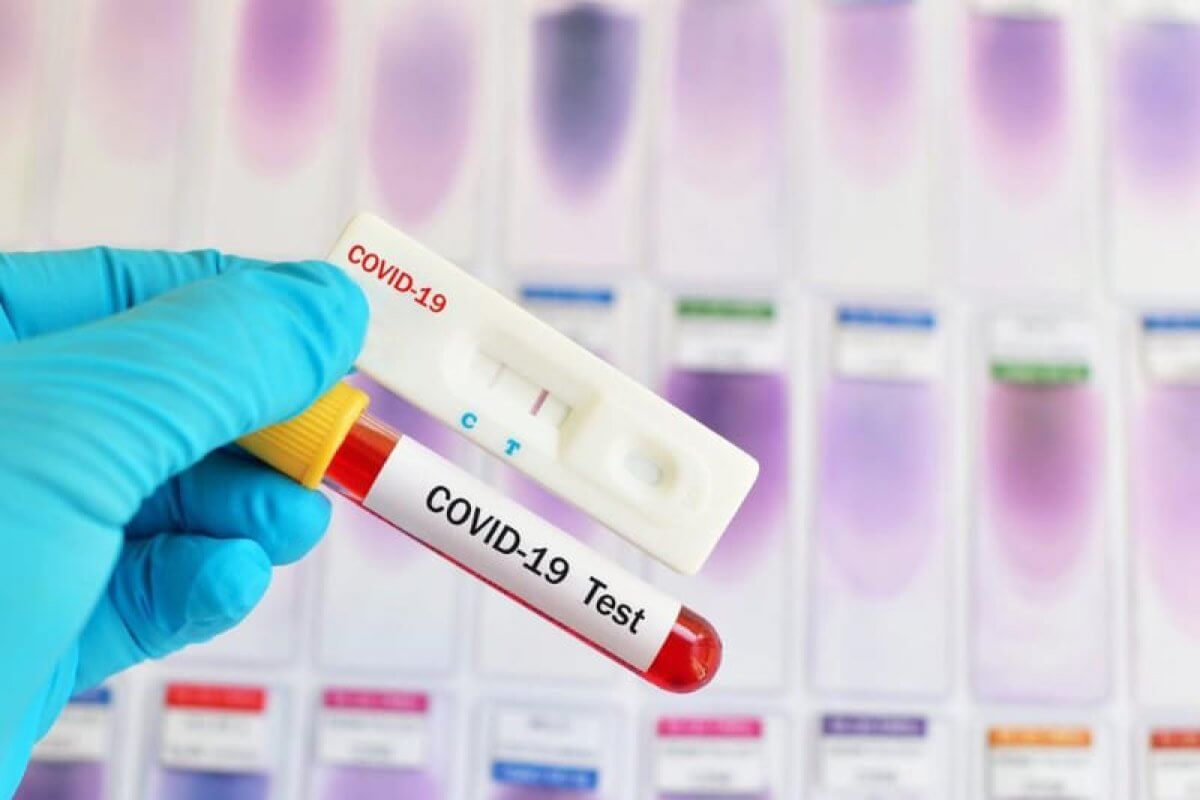 Уже у 108 пациентов с COVID-19 в Хакасии тяжелая форма заболевания