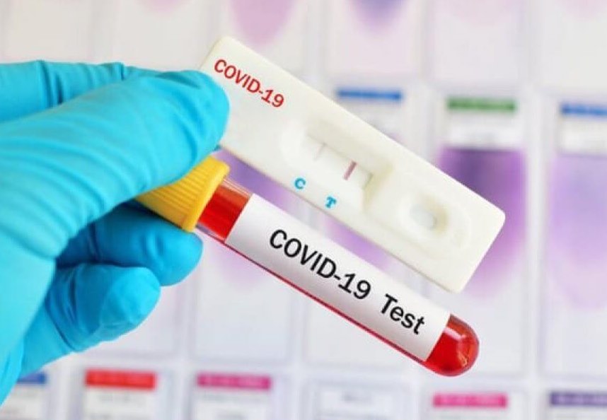 COVID-19: в Хакасии за сутки выздоровел 1 человек, заболело - 23