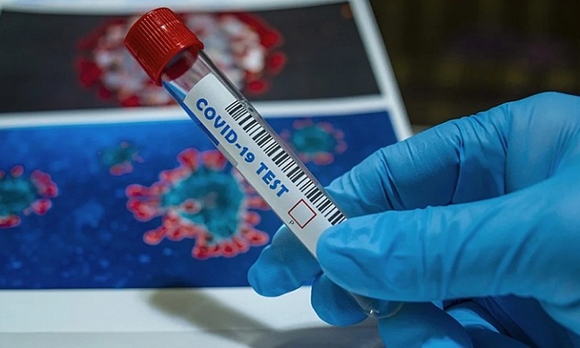 В Хакасии за сутки 22 человека заразились COVID-19, излечились - 52