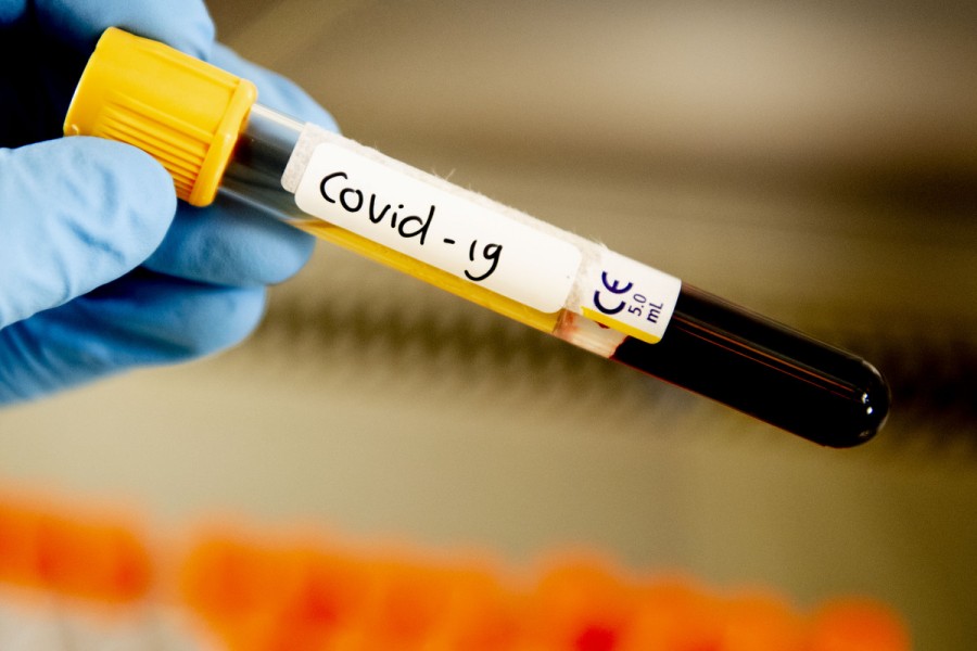 Уже больше четырех тысяч жителей Хакасии заразились COVID-19