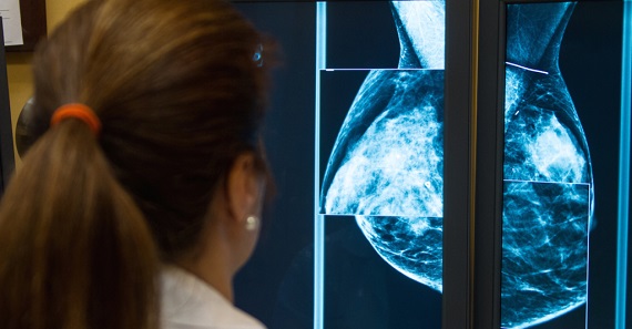 Жительниц Хакасии зовут пройти маммографию