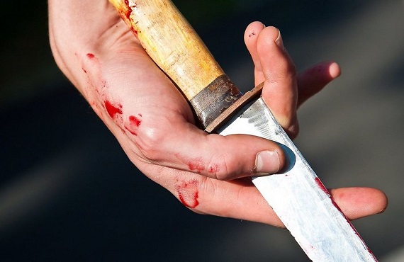 В Абакане возле общежития от ножевых ранений скончался мужчина