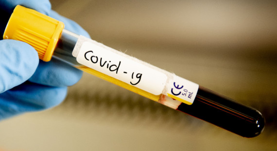 Ученые выявили связь группы крови со смертностью от COVID-19