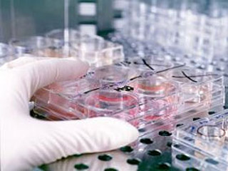  В Хакасии выявлено 12 случаев свиного гриппа
