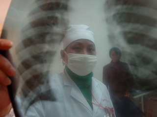 Заболеваемость туберкулезом в Хакасии на 30-40% превышает среднероссийский уровень