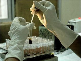 В Абакане регистрируется самое большое количество ВИЧ-инфицированных