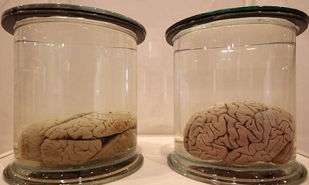 Из Техасского университета украли 100 банок с человеческими мозгами