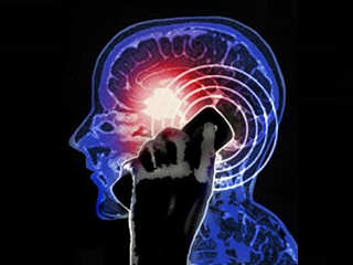 На возникновение опухоли мозга мобильник не влияет - ВОЗ