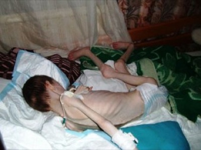 27 детей умерли от голода в Кемеровской области