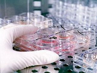 Из 54-х зараженных свиным гриппом жителей Хакасии умерло 5 человек