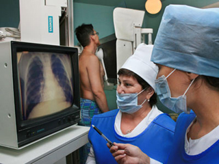На борьбу с туберкулезом в Хакасии выделят дополнительные средства
