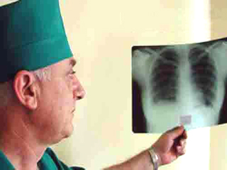 Туберкулез в Аскизском районе остается серьезной проблемой